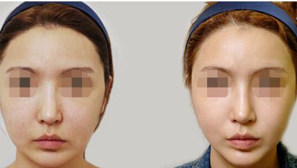 2023年北京磨骨醫(yī)院榜單揭曉！找尋醫(yī)療服務(wù)只需輕輕一點(diǎn)