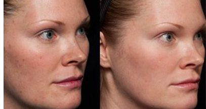 紹興皺紋激光修復(fù)醫(yī)院口碑榜單：前10強(qiáng)實(shí)力大揭秘！