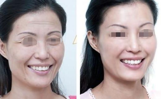 武漢魚尾紋整形美容醫(yī)院口碑榜：告別皺紋困擾，綻放青春光彩