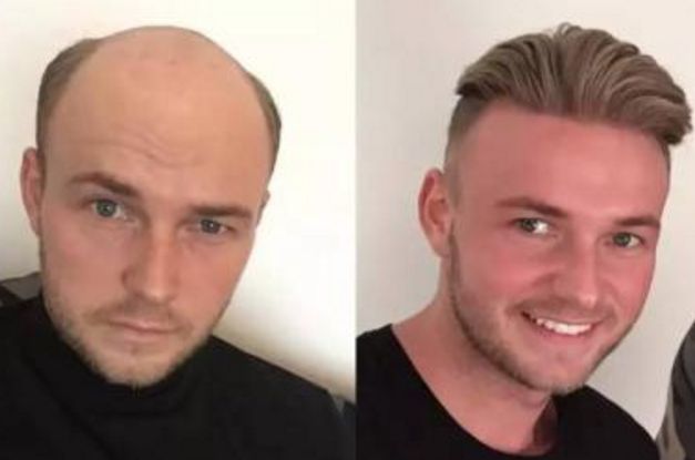 上海磨骨查看：公立私立整形醫(yī)院綜合評價火爆！TOP10實力人氣排行！