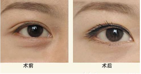 廣州靜態(tài)紋改善推薦：前十家備受矚目的醫(yī)美機(jī)構(gòu)