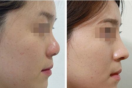 濟南印第安紋修復(fù)醫(yī)院口碑排名前十強詳解！