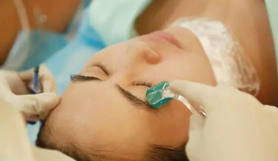 彩光嫩膚有用嗎？彩光嫩膚有什么副作用嗎？