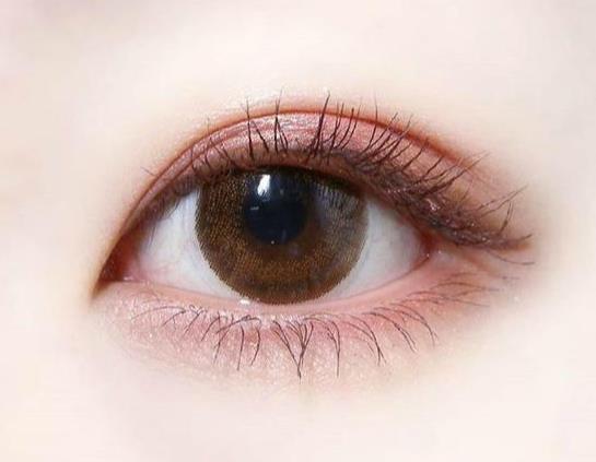 韓式埋線雙眼皮多少錢？韓式埋線雙眼皮的價格大概是多少？