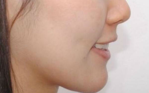 貴陽祛除黑眼圈醫(yī)生