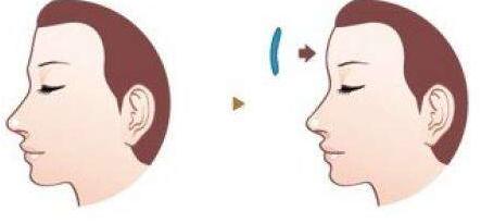 2023合肥超導(dǎo)光波治咖啡斑前十強(qiáng)醫(yī)生強(qiáng)榜均是實(shí)力派！楊松、王維堂、金翰成實(shí)力盤點(diǎn)推薦