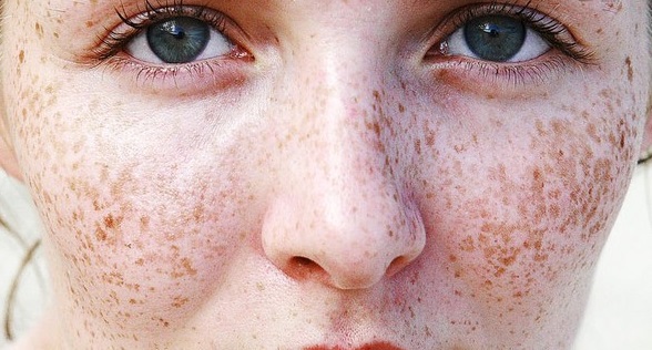 駐馬店光子去口周紋醫(yī)生