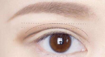 2023威海面部微創(chuàng)提拉手術(shù)醫(yī)生前十名排名榜獨(dú)家測(cè)評(píng)，劉飛宏、畢建軍、鄭真伊比較靠譜