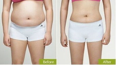 2023蘇州光子嫩膚去斑醫(yī)生前十強強榜測評別錯過！梁志偉、謝云、曹振各自優(yōu)勢是什么？