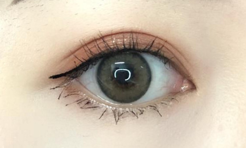 南京負(fù)壓去黑頭醫(yī)生