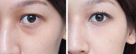 2023佛山兔唇top10的醫(yī)生技術(shù)牛!陳俊武、孫增勤、蘇暉展行業(yè)強(qiáng)中強(qiáng)！