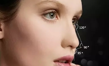 南京面部填充細(xì)紋醫(yī)生