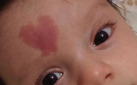 2023深圳自體填充去唇紋推薦前10位醫(yī)生技術抓抓抓！劉亞慧、唐建軍、康春雨口碑top齊聚