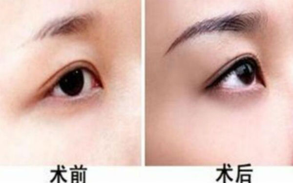 2023上海鐳射激光祛斑醫(yī)生排名榜top10強(qiáng)哪個(gè)比較好？李宏毅、陳玉琴、曹芳讓我們一起來(lái)看看