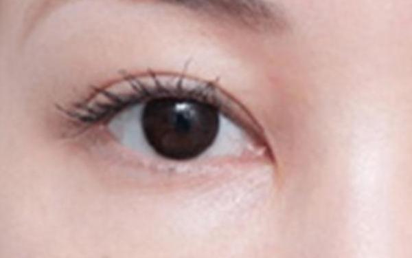 2023廈門懸吊術(shù)提胸醫(yī)生排行榜前10名權(quán)威發(fā)布~郭凱、李強(qiáng)、鄭慶亦超強(qiáng)人氣醫(yī)生名單收藏