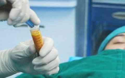 2023鄭州抽脂手術(shù)減肚子排行前10強的醫(yī)生好不好？李勁良、宋賢磊、朱志娟正規(guī)又有實力！