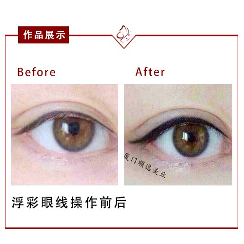 鹽城瘦臉醫(yī)生