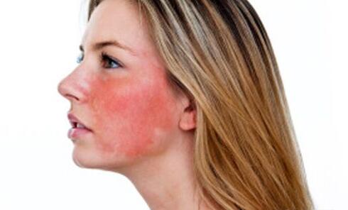 2023南京激光去除雀斑口碑醫(yī)生哪個(gè)醫(yī)院好?趙耀忠、王金玉、郭敏不妨來(lái)看