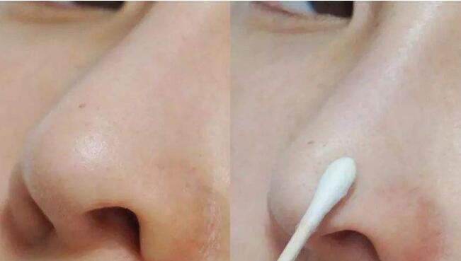 2023蘇州超聲溶脂瘦面部正規(guī)醫(yī)生上榜前十強(qiáng)可不可靠！鄭銳、胡強(qiáng)、郝思輝領(lǐng)銜榜首~