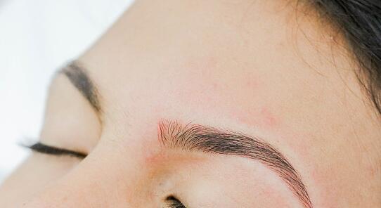 2023廈門眉間紋整形醫(yī)生top10強榜口碑擅長評測！李萬福、劉歆、陳石海高人氣機構(gòu)