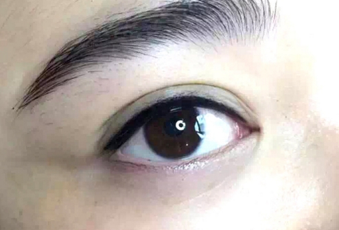 2023南寧面部微創(chuàng)提拉手術(shù)醫(yī)生強(qiáng)榜前十名實(shí)力評(píng)出！余德慶、池剛毅、陳美慶實(shí)力確實(shí)靠譜