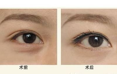 2023佳木斯激光溶脂去狐臭正規(guī)醫(yī)生排名榜前十強(qiáng)提前參考！姚穎、付曉慧、周文旭私立預(yù)約方便！