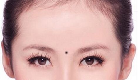 2023重慶肉毒素祛疤痕疙瘩醫(yī)生TOP10口碑榜熱門分析！沈勇成、楊天榮、陳海琴榜單打卡不踩坑