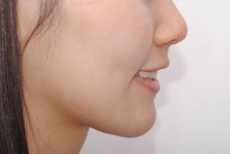 2023西安去腑臭醫(yī)生TOP10強(qiáng)排名名單盤點(diǎn)！趙春英、裴大偉、張筠莉名氣大實力強(qiáng)