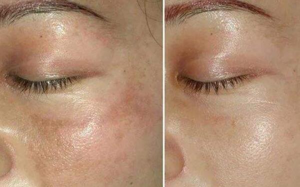 2023汕頭額頭紋凹陷填充醫(yī)生前10名排名預(yù)評(píng)測(cè)！何斌、皮先榮、鄭敏各具實(shí)力和風(fēng)采