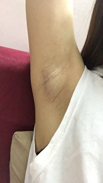 2023東莞多波長(zhǎng)激光祛斑美膚醫(yī)生排行榜前十強(qiáng)快速盤(pán)點(diǎn)！何嵐、盧求珍、鐘小龍實(shí)力價(jià)格多方面可參考