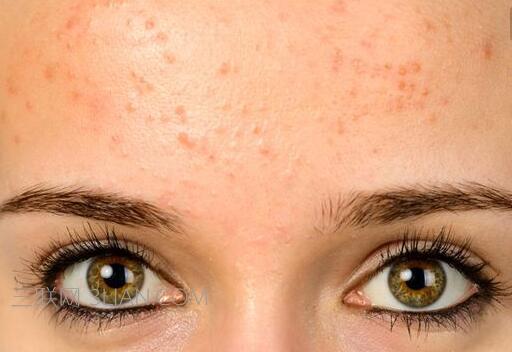 2023三亞納米雙眼皮專家TOP10強上榜清單橫評，杜經(jīng)緯、秦雷、丁歐歐專業(yè)解答技術(shù)優(yōu)勢！