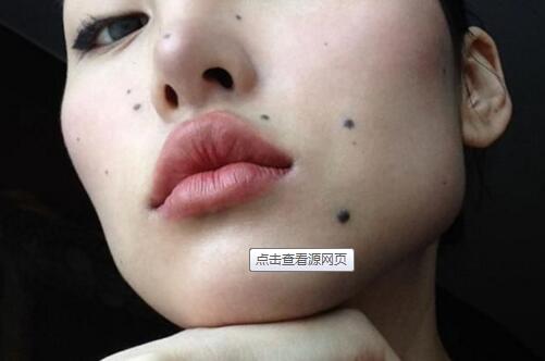 2023浙江點陣激光祛眼底紋排行前十強的醫(yī)生實時更新！林輝、沈聰聰、魯新憑實力入圍