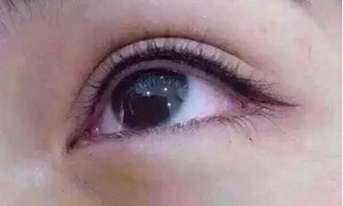 2023唐山水光針祛妊娠紋榜單前10專家簡介不容錯過！王景峰、孫長生、白玲爭奪榜前三桂冠