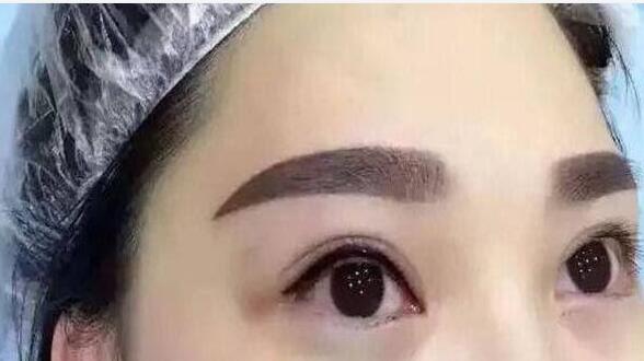 2023寧波光纖溶脂瘦臉大正規(guī)專家上榜TOP10強全新預評！王國尚、方振玉、劉成林老牌醫(yī)生口碑出眾！