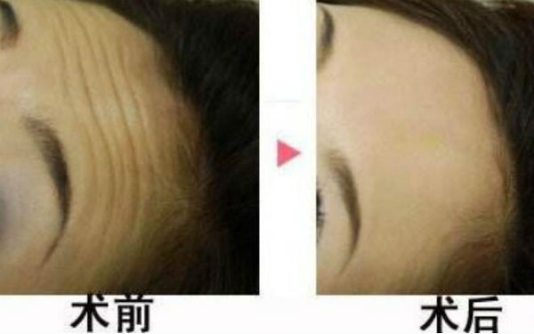 2023襄陽面部激光溶脂正規(guī)醫(yī)生上榜前幾強(qiáng)強(qiáng)來襲！涂文浩、鐘磊、胡勤修實(shí)力強(qiáng)勁更安心