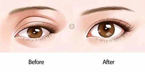 2023溫州溶脂瘦大腿推薦十強(qiáng)醫(yī)生榜單大盤點(diǎn)！徐艦、陳永、張小兵口碑好收費(fèi)良心