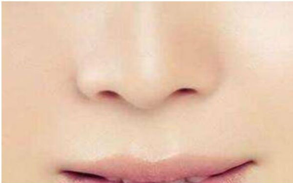 2023德陽(yáng)肥厚鼻翼整形評(píng)分十強(qiáng)醫(yī)生匯總介紹~蔣克鋒、馮光、姜晉生選它