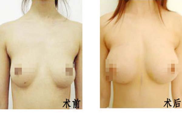 2023中山朝天鼻矯正術(shù)強(qiáng)榜前十的專家名次查詢！崔鳳均、宋彥、高洪君深入網(wǎng)友傾心