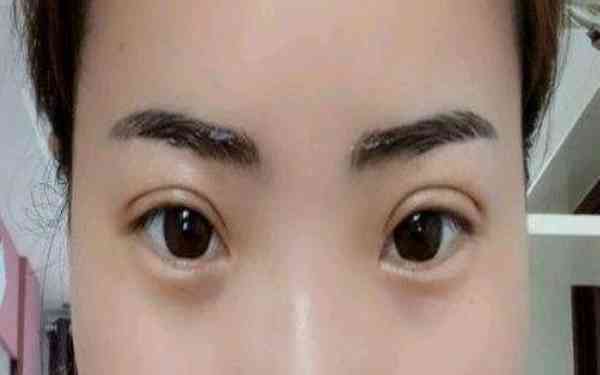 馬鞍山射頻點(diǎn)陣祛痘醫(yī)生