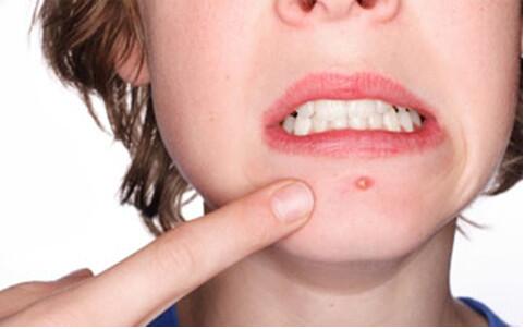 海南脂肪填充臉醫(yī)生