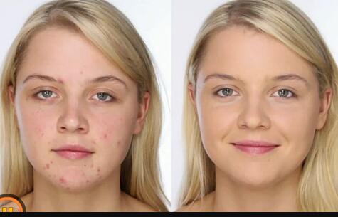 2023廣州無針去頸紋醫(yī)生前10名上榜名單合集公示！黃美興、張鑄、穆大力公立機(jī)構(gòu)醫(yī)生常駐榜單