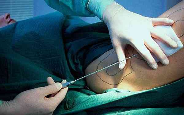 2023桂林彩光嫩膚祛痘權(quán)威專家排名前十強名單花落誰家！嚴美、謝雪玲、高廣華實力及價格呈現(xiàn)