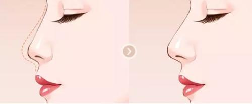 2023長(zhǎng)沙光子嫩膚對(duì)去紅血絲醫(yī)生前十名強(qiáng)榜更新匯總~趙蓉、田芳斌、高新民備受粉絲青睞！