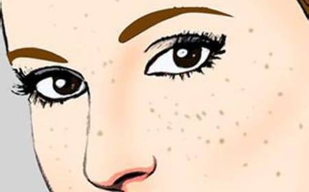 南寧凹陷性疤痕修復醫(yī)生