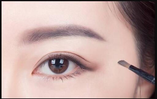 義烏玻尿酸填充眼瞼凹陷醫(yī)生