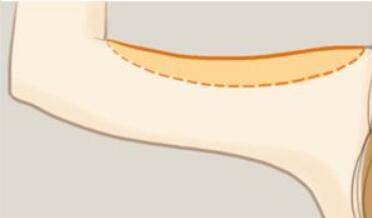 海南線雕大v線醫(yī)生