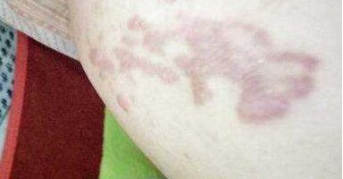 蘇州微創(chuàng)豐胸治療價(jià)位表預(yù)覽(2023蘇州微創(chuàng)豐胸參考價(jià)為：7186元)