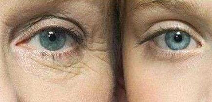 深圳激光去頸紋手術(shù)費(fèi)用2023明細(xì)查看(深圳韓美整形美容門診部激光去頸紋手術(shù)參考價(jià)：4570元)