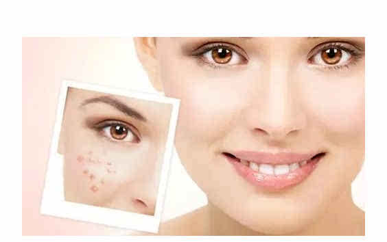 廣西光子祛黑眼圈治療價(jià)格全新呈現(xiàn)(柳州工人醫(yī)院美容整形科光子祛黑眼圈參考價(jià)：5786元)