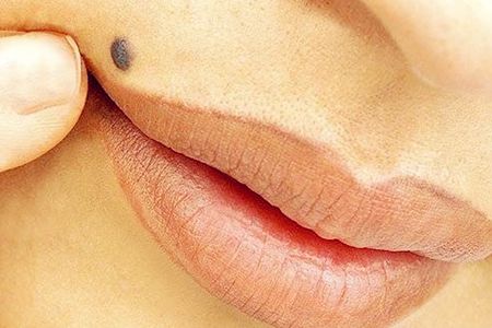 佛山注射瘦腿針手術(shù)價(jià)格詳細(xì)版本查看(佛山順德區(qū)壹加壹瑪利亞整形美容醫(yī)院注射瘦腿針參考價(jià)：3144元)